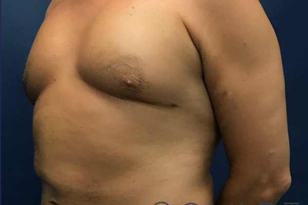 Central Physique SCULPTing