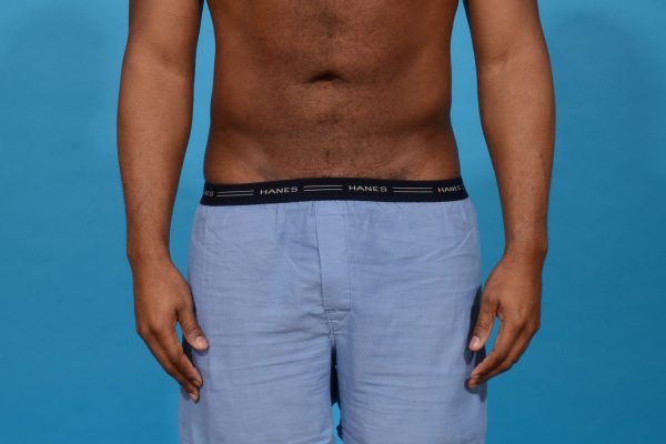 Central Physique Etching in Dallas, Texas